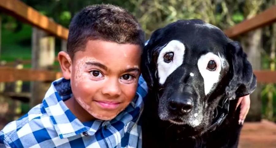 boy and dog with same skin condition