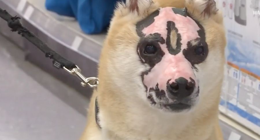 Burn Victim